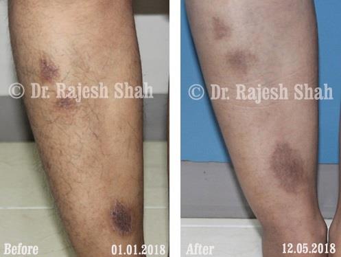lifeforce homeopathy case-photos